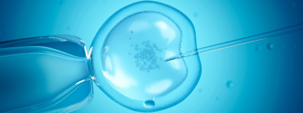 mini ivf